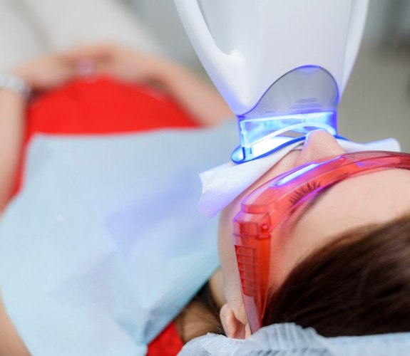 Person undergoing in-office teeth whitening 